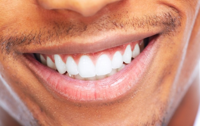 Closeup of flawless smile after teeth whitening