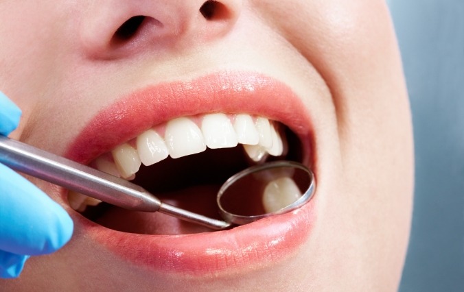 Patient's smile after metal free dental restorations