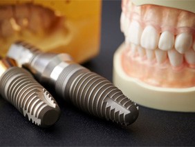 removeable implant dentures 