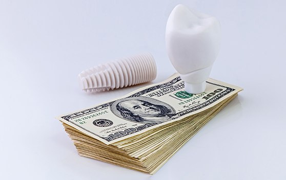 Dental implant on stack of cash