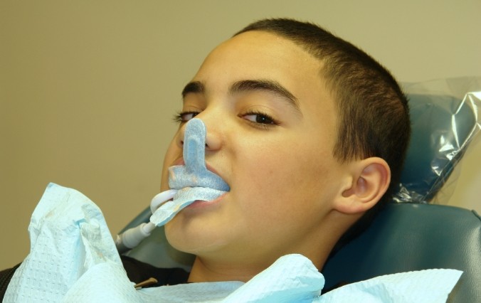 Patient receiving fluoride treatment