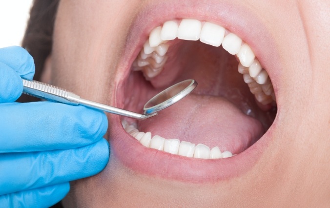 Patient receiving oral cancer screening