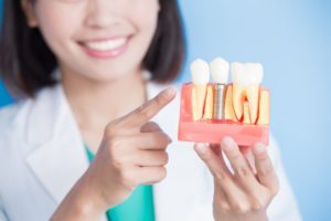 a patient visiting the dentist for their dental implant consultation